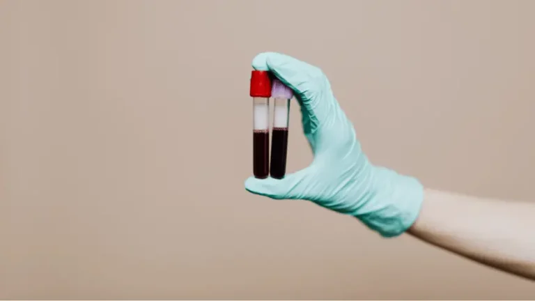 Hand holding two blood sample tubes